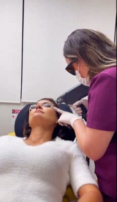 Michelle realizou tratamento para melasma e micropigmentação de sobrancelha - Divulgação Michelle realizou tratamento para melasma e micropigmentação de sobrancelha - Divulgação
