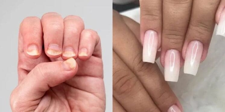 Pra nunca mais pisar na manicure: Alongamento de unhas 100% caseiro rejuvenesce até as 60+ com só 5 passos