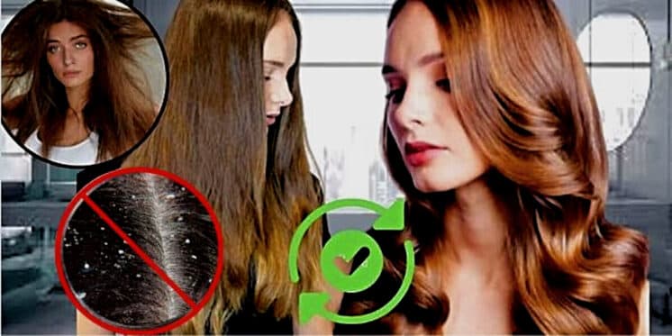 Para exterminar as caspas e pontas duplas: Ingrediente milagroso ressuscita qualquer cabelo estragado