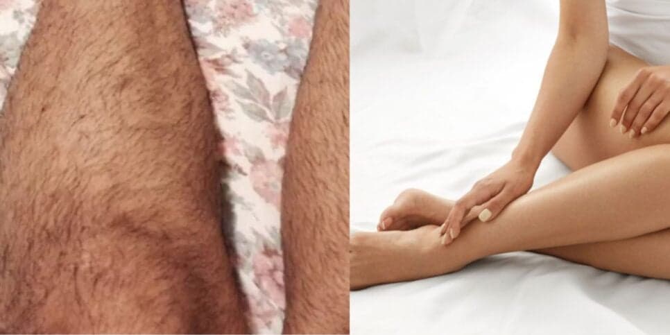 Nem a Espaço Laser faz isso: Misturinha com 7 ingredientes acaba com os pelos melhor que cera definitivamente