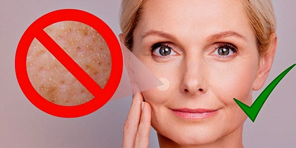 Poros fechados imediatamente: 6 passos INFALÍVEIS para garantir uma pele de bebê em casa em apenas 7 dias