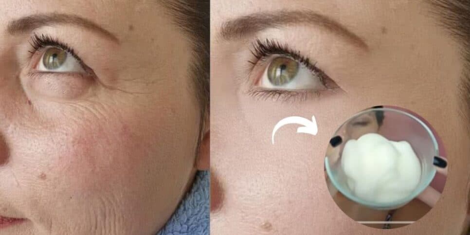 Harmonização facial caseira: 2 segredos milagrosos para rejuvenescer 15 anos em 20 minutos