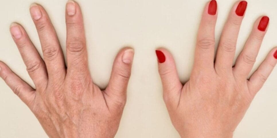 Mãos 30 anos mais jovem: Misturinha com apenas 3 ingredientes dá adeus ao ressecamento e aos calos em 5 minutos