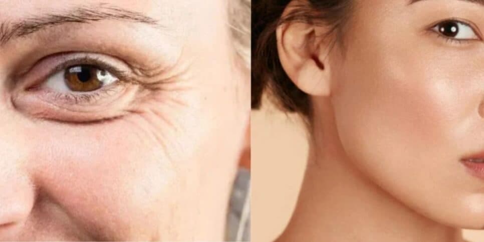 Nem a AVON tem: Receita natural de ácido hialurônico com cenoura e +3 itens deixa a pele como se tivesse 25 anos