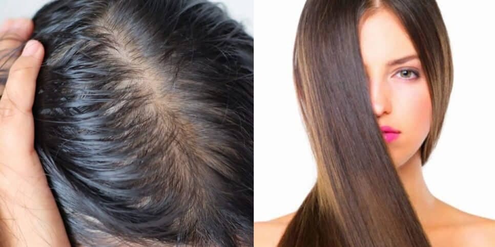 Fim ao cabelo oleoso por menos de 100: 3 melhores shampoos mais populares do momento