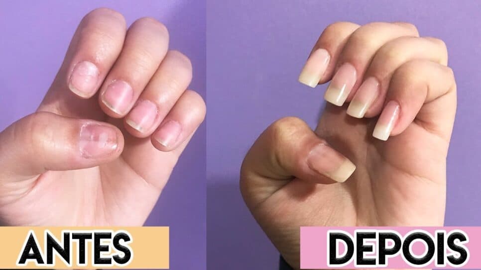 Alongamento de unhas caseiro (Foto: Reprodução/ Internet) Alongamento de unhas caseiro (Foto: Reprodução/ Internet)