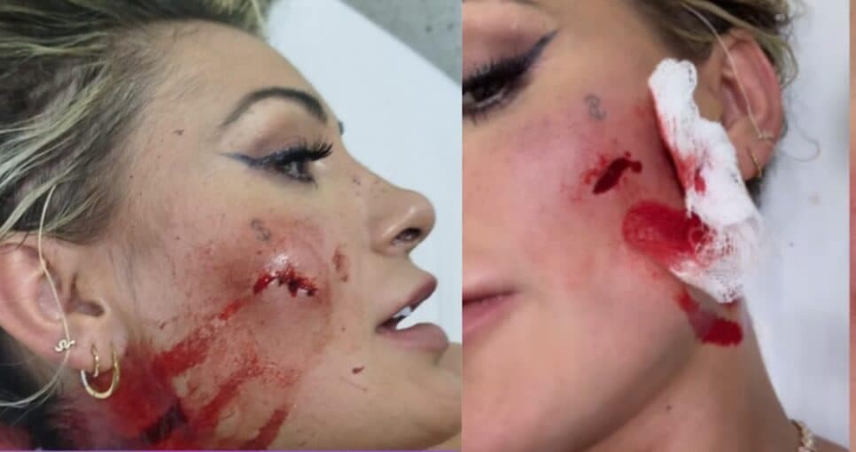 Andressa Urach cospe na cara de famosa, leva surra em pancadaria e surge em foto com rosto ensanguentado