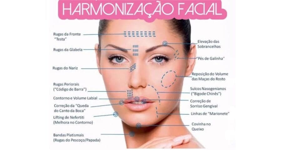Apesar de famigerada, uma harmonização pode ser bem cara (Foto Reprodução/Florida Estética) Apesar de famigerada, uma harmonização pode ser bem cara (Foto Reprodução/Florida Estética)