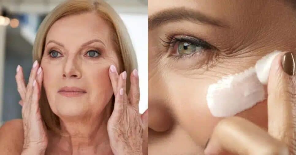 Pomada pra rugas com 5 ingredientes traz pele de porcelana - Foto Reprodução Internet Pomada pra rugas com 5 ingredientes traz pele de porcelana - Foto Reprodução Internet