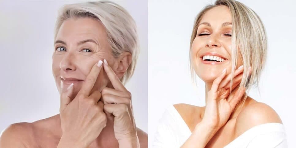Único ingrediente natural +1 passo sugam rugas profundas (Foto: Reprodução/ Freepik) Único ingrediente natural +1 passo sugam rugas profundas (Foto: Reprodução/ Freepik)