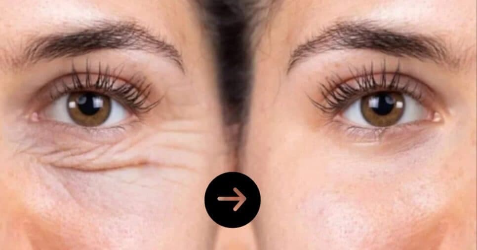 Pele de 20 anos para sempre: Mistura com 2 ingredientes acaba com rugas e manchas instantaneamente