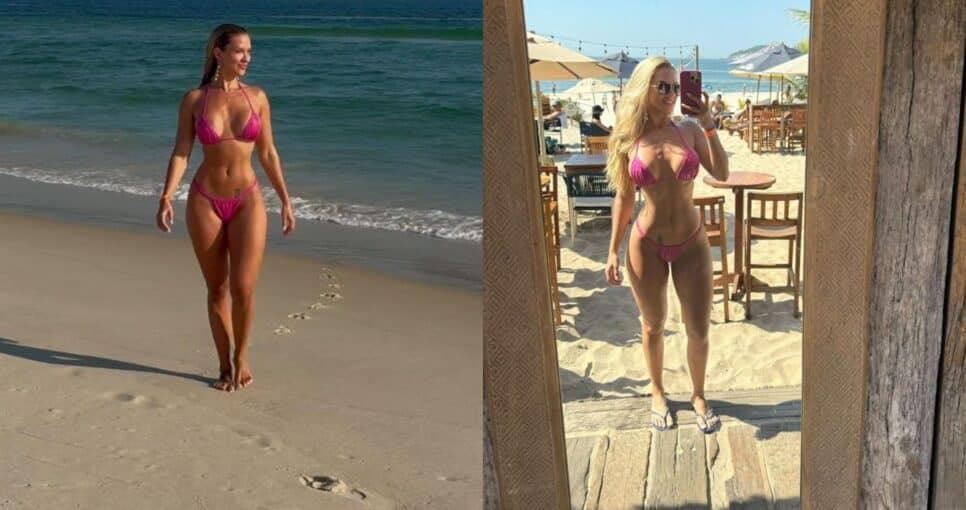 Concurso de beleza exige e ‘Miss Cinturinha’ faz raio X para provar que não retirou costela