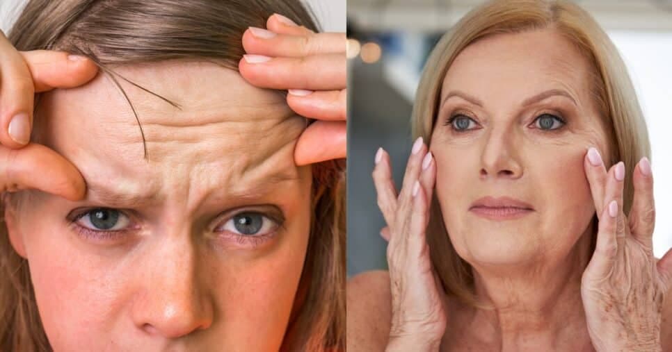 Pele de porcelana: Botox caseiro com 4 ingredientes preenche rugas de idosas 60+