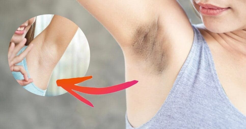 Fim do pelo encravado e manchas: 4 receitas naturais para clarear axilas e poupar rios de dinheiro no salão