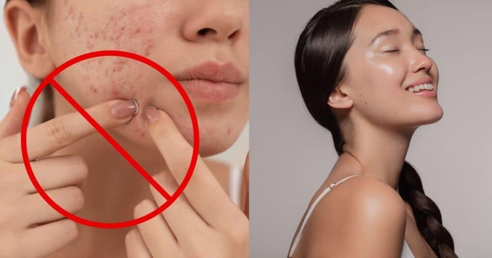 Fim das espinhas e poros fechados para sempre: Único ingrediente traz pele de bebê às mulheres 40+