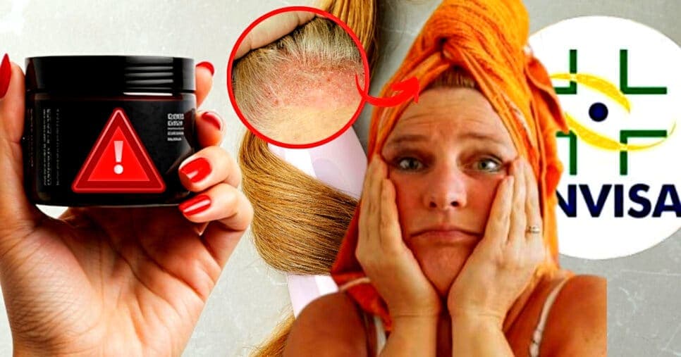 Risco de feridas na cabeça: ANVISA emite proibição contra creme de hidratação nº1 das 45+