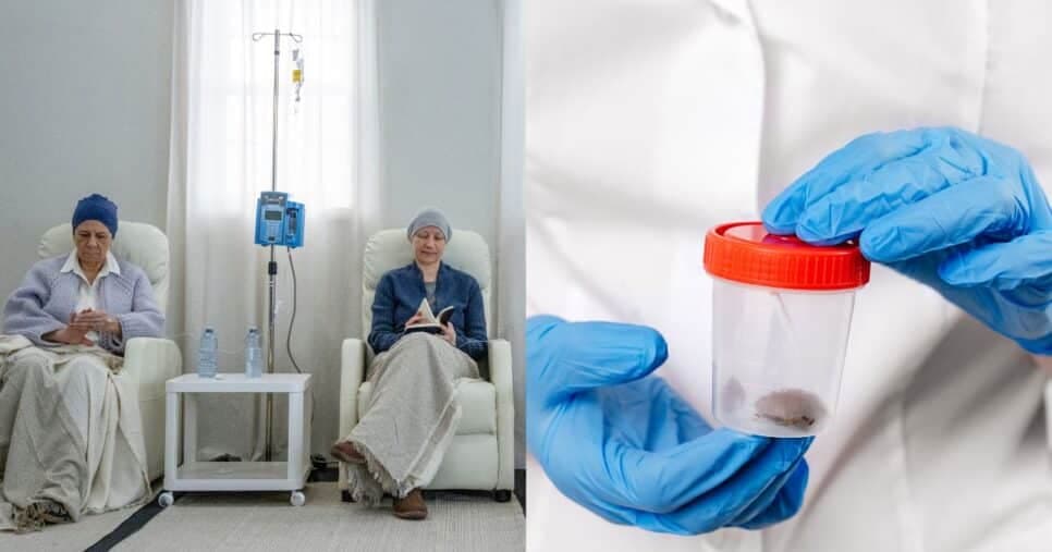 Estágio avançado: Cor das fezes indicam diagnóstico de câncer do intestino e idosos 60+ devem se atentar HOJE