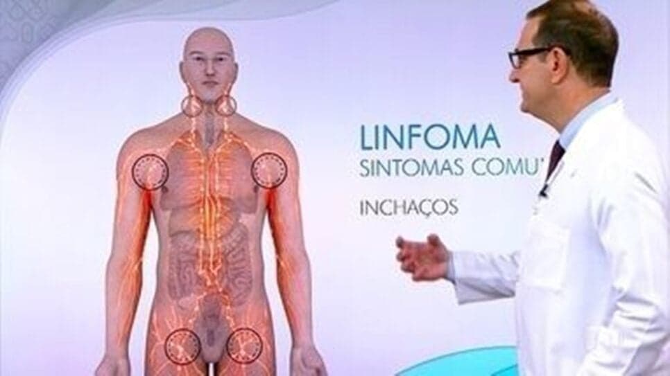 3 sintomas cruciais do câncer chamado de linfoma não-Hodgkin (Foto: Reprodução/ Globoplay) 3 sintomas cruciais do câncer chamado de linfoma não-Hodgkin (Foto: Reprodução/ Globoplay)
