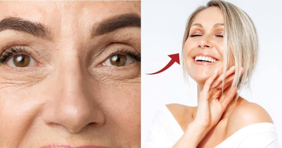 Botox com 2 ingredientes sugas as rugas e estica a pele das 60+ (Foto: Reprodução/ Internet) Botox com 2 ingredientes sugas as rugas e estica a pele das 60+ (Foto: Reprodução/ Internet)