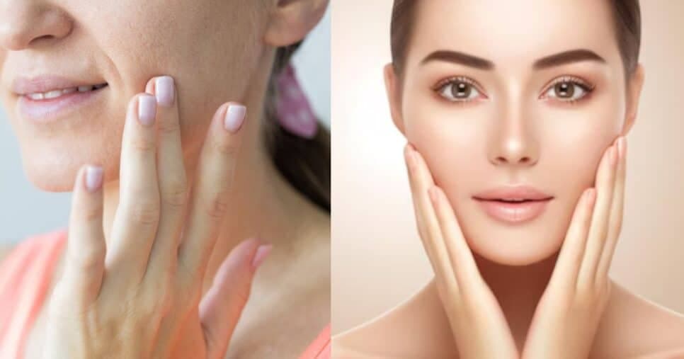 Mulheres estão largando o botox: Produto de farmácia reduz linhas finas em uma semana
