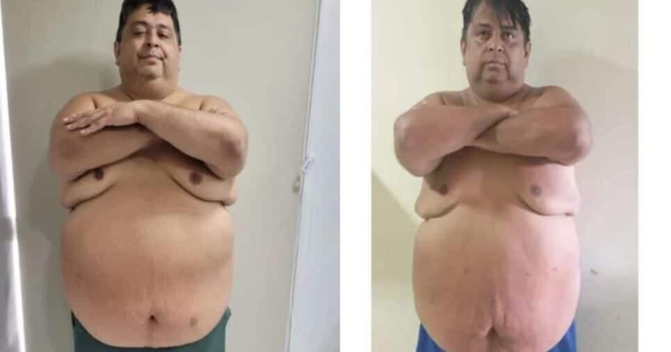 Anderson Souza, dono da Puskas Bet, revela sua jornada de superação após bariátrica: “isso é para meu filho também”