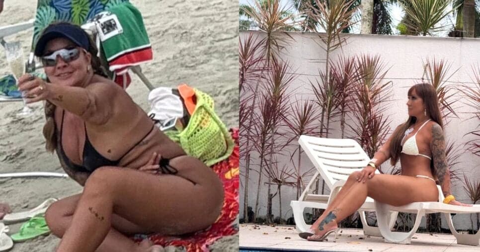 Após atingir 83 KG, a atriz Vivi Fernandez realiza série de cirurgias plásticas