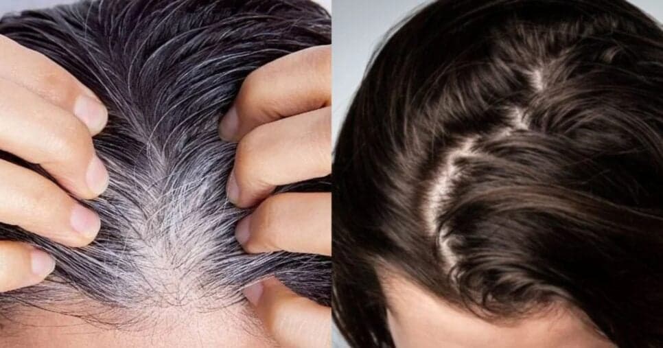 Adeus, cabelo branco: Tinta natural com 3 ingredientes populares faz mulheres 50+ ficarem 10 anos mais jovem