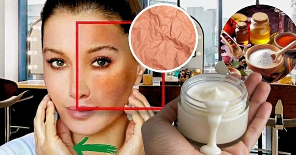 Chapéu nas rugas: Creme caseiro, com 3 ingredientes, traz pele de pêssego em 20 minutos