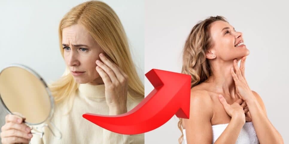 Pele de porcelana: Mistura natural com 4 ingredientes acaba com as rugas das 40+ sem química