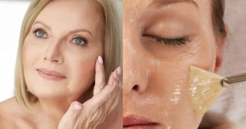 Efeito de peeling sem gastar nada: Máscara preenche linhas finas e rejuvenesce a pele em apenas 15 minutos