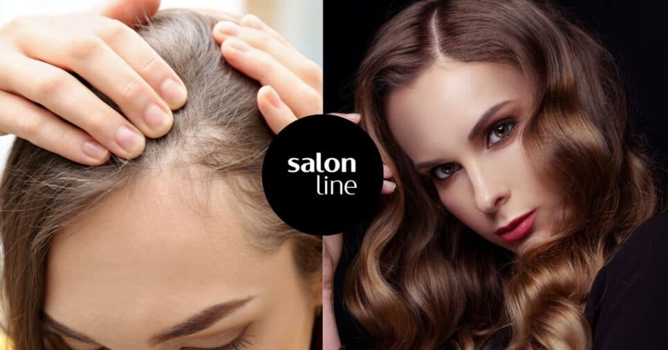 Fim da queda e fios ralos: 4 produtos poderosos da Salon Line trazem bomba de força para o cabelo por R$ 56
