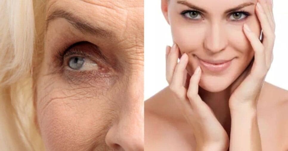 Tchau, peeling e velhice: Receitinha com 4 ingredientes traz melhor colágeno do mundo as 60+