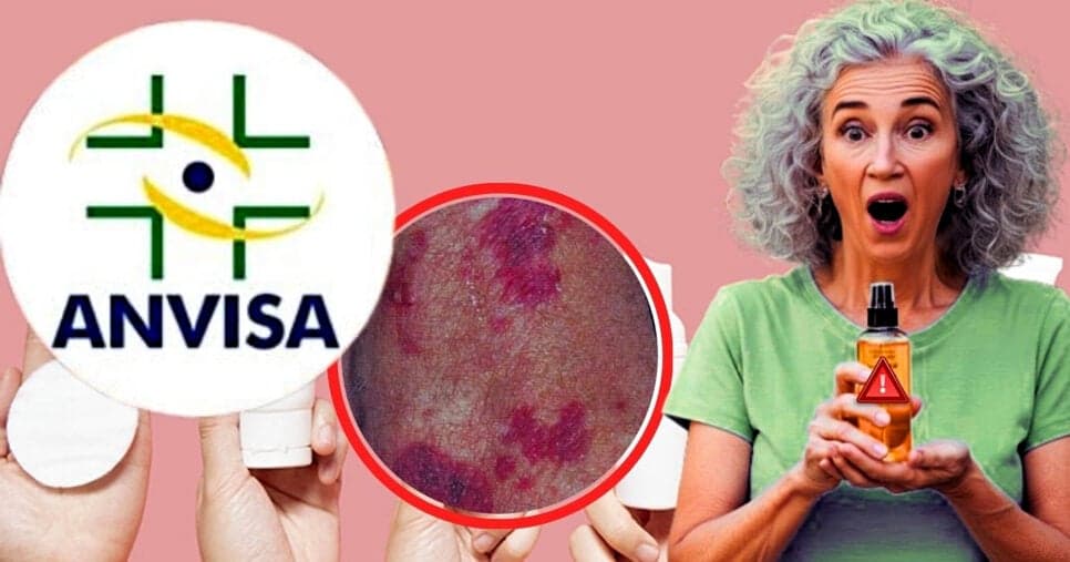 Risco de vermelhidão e coceira: ANVISA proíbe óleo nº1 da pele dos 60+ após descoberta em 2025