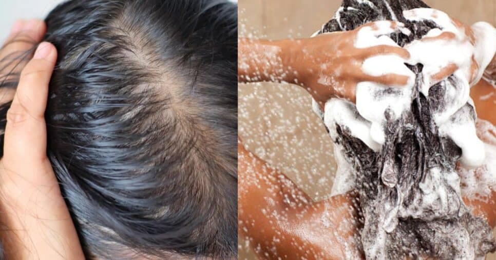 3 shampoos para controlar a oleosidade da raiz sem ressecar as pontas
