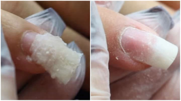 Tudo sobre o truque para colar sua unha quebrada sem precisar fazer uso de gel - Foto Internet Tudo sobre o truque para colar sua unha quebrada sem precisar fazer uso de gel - Foto Internet