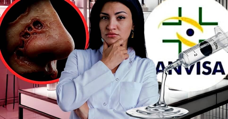 Risco de necrose: Denúncia faz ANVISA baixar facão e proibir marca de Botox por grave descoberta