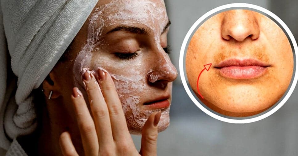 Melhor que peeling: Essa máscara caseira remove manchas em apenas 15 minutos