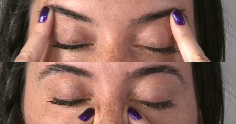 Círculos ao redor dos olhos- Foto: YouTube Círculos ao redor dos olhos- Foto: YouTube