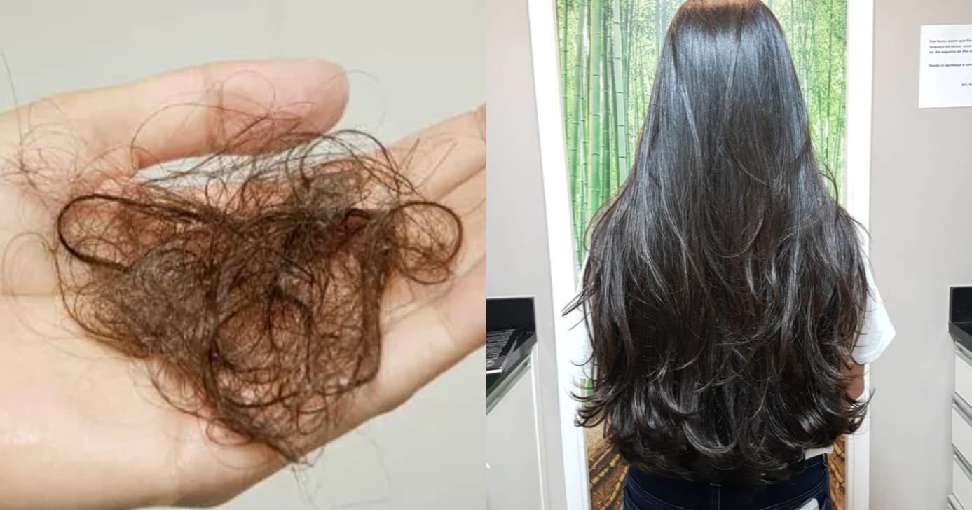 Adeus queda de cabelo: Vitamina barata de farmácia faz o fio crescer 3x mais rápido
