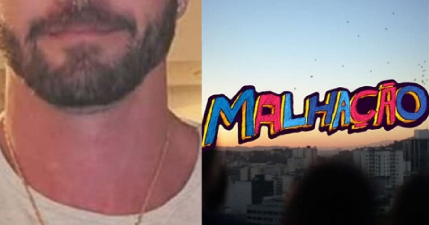 Galã de Malhação se acidenta no sexo e sai com rosto sangrando: “Pânico”